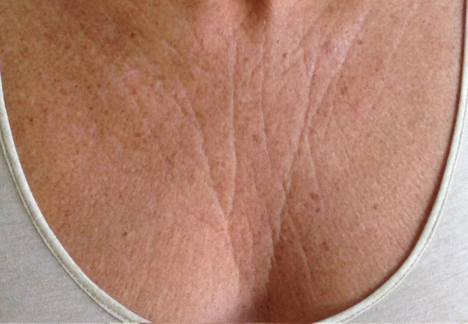 Chest_Before