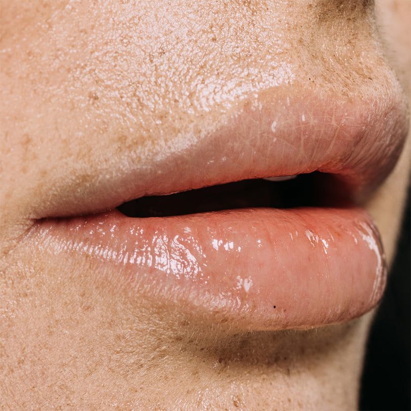 mouth_wrinkle_patches_for_marionette_lines_and_fine_lip_line_wrinkles