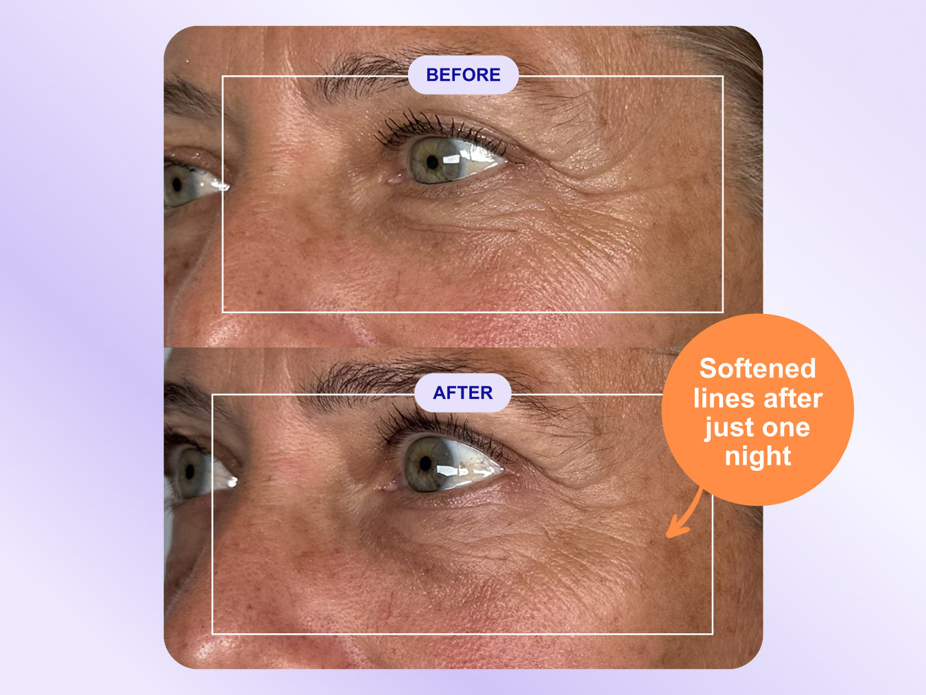 No Needles, No Downtime – That’s Why These Eye Wrinkle Patches Are Everywhere