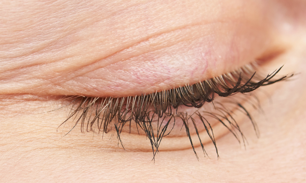Botox? Dysport? Silicone Patches? Let’s break it down.