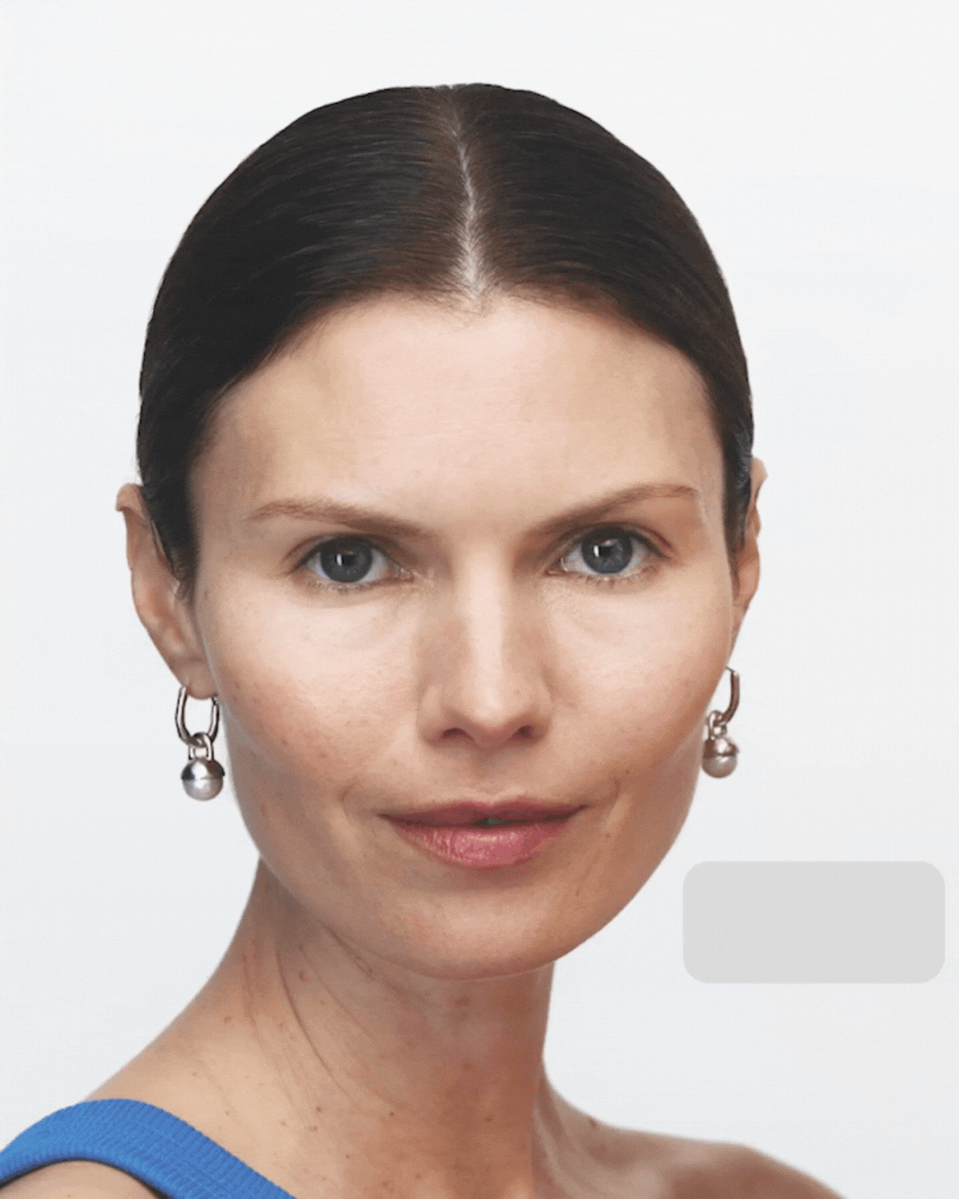 aesthetic treatments Alternative: The Secret to Smooth Skin Without the Frozen Face