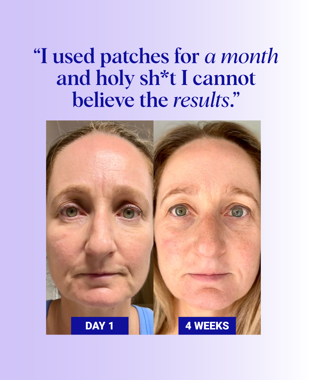 Do Silicone Patches Work? One Woman's Incredible 4-Week Skin Transformation with Consistent Patching