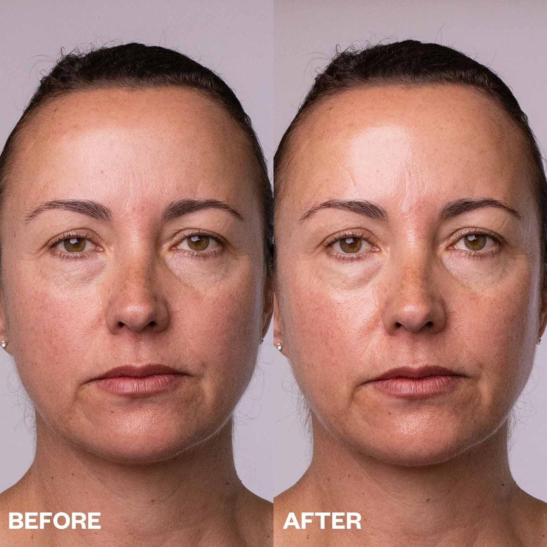 Hydrate & Smooth Eye Set