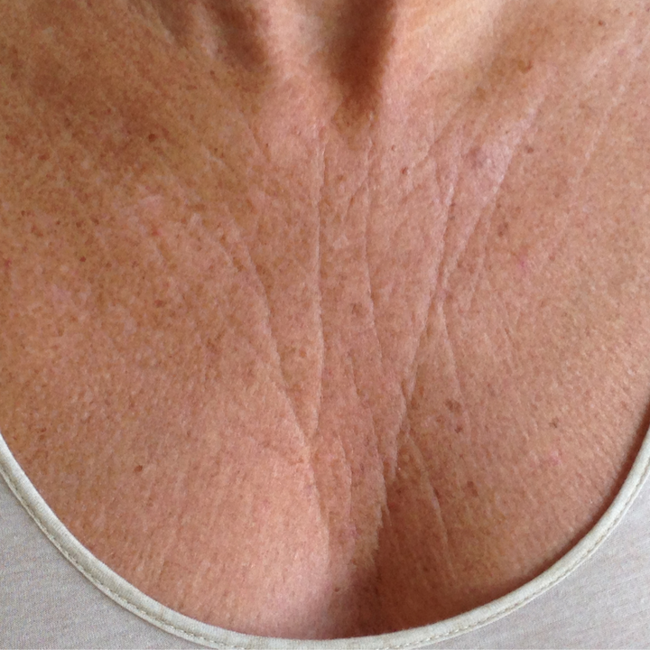 Antiwrinkles Décolleté and Chest Silicone Patches