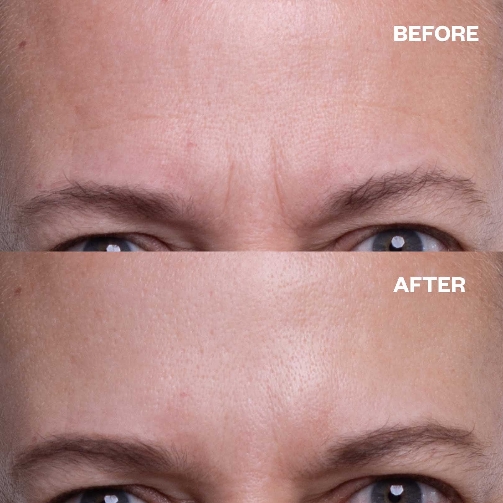 Face Plumping Duo | WRINKLES SCHMINKLES – Wrinkles Schminkles
