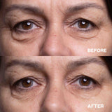Before and after results using Travel Minis Bundle for crow's feet and under-eye wrinkles