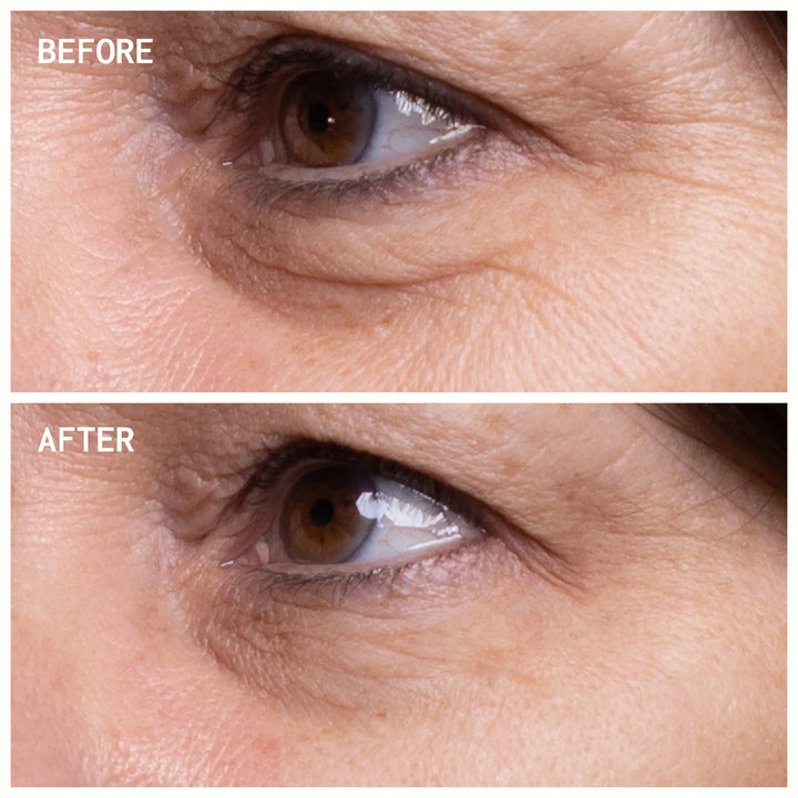 Eye Wrinkle Patches | Trial Pair
