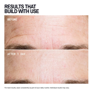 Forehead Wrinkle Patches
