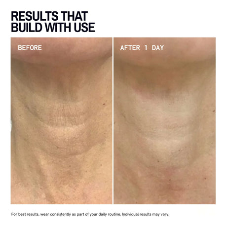 Neck Wrinkle Patches