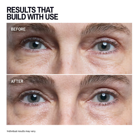 Eye Smoothing & Depuffing Mask - 5 Pairs